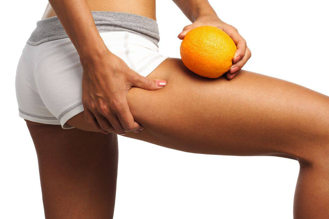 Tout Savoir sur La Cellulite : Comment y Remédier ? - Suplemint